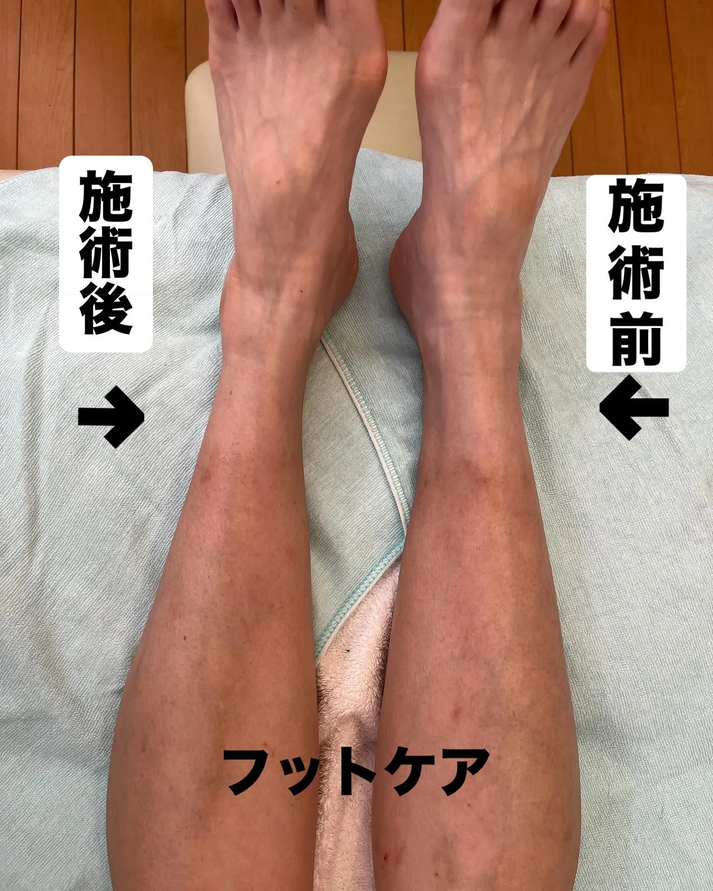 足の疲れにはフットケアがおすすめ！