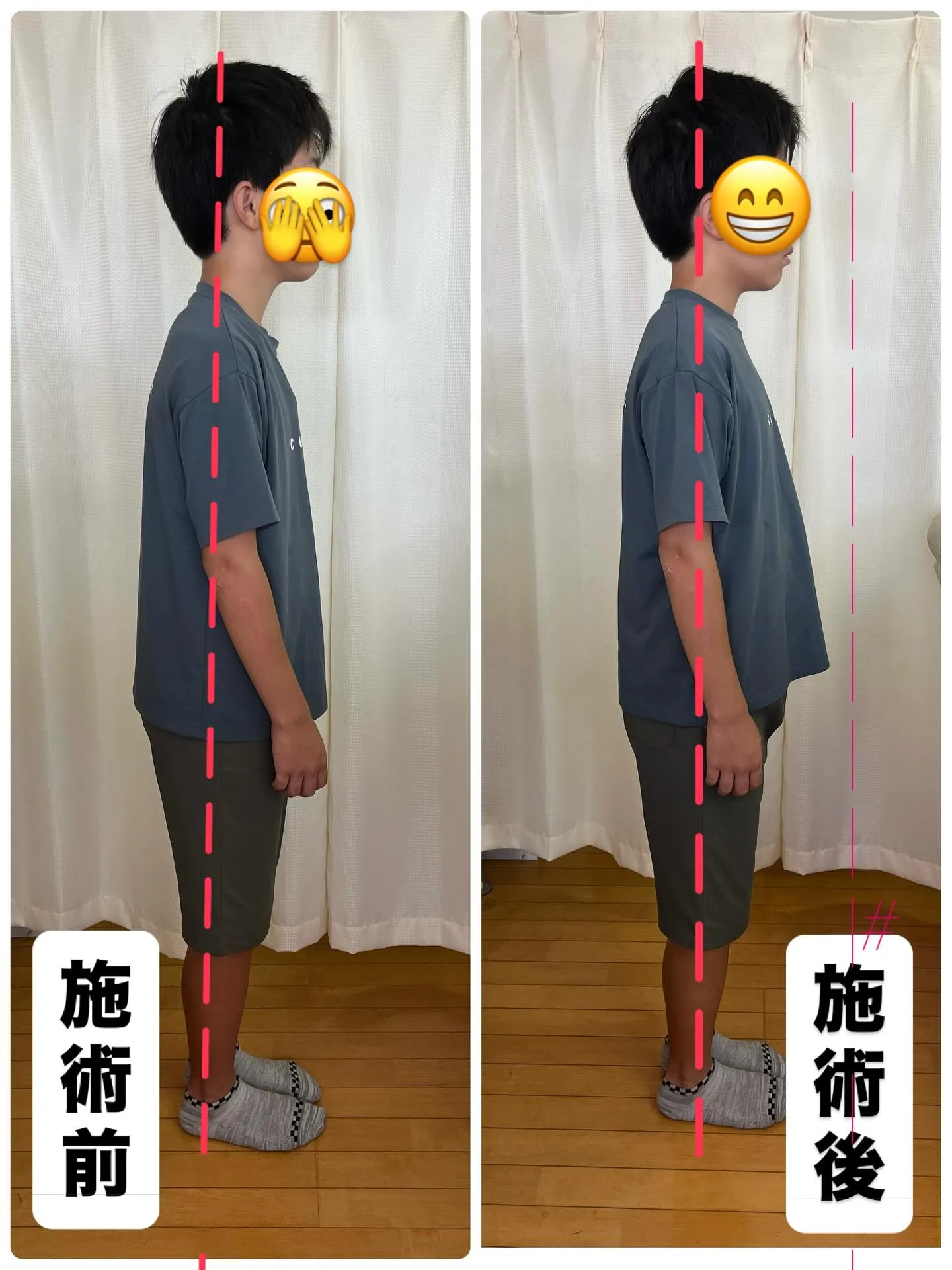 全身整体、骨盤矯正で体の前後のバランスが良くなりました。